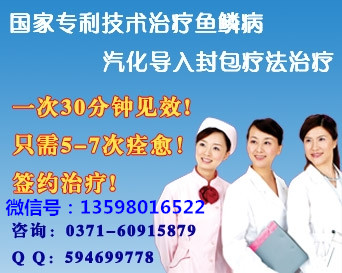 得了鱼鳞病清洗患处时应注意什么