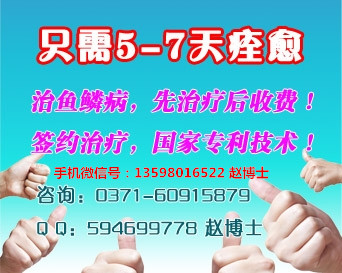 鱼鳞病如何让男人爱女人的11个技巧