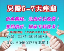 鱼鳞病如何让男人爱女人的11个技巧