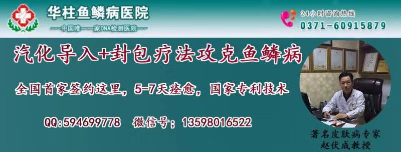 那么儿童鱼鳞病怎么治愈呢