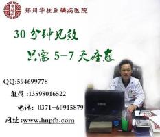 早期脱皮的时候有点像鱼鳞病的症状