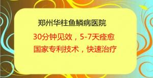 鱼鳞病患者心衰的五大『信号』