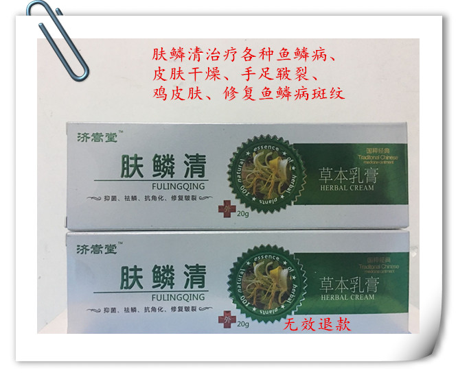 邢台市怎么治疗鱼鳞病效果好
