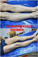 口服药治疗鱼鳞癣都存在一个明显的优势