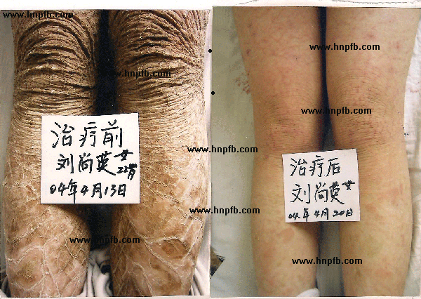 让干性皮肤早衰的 十个坏习惯
