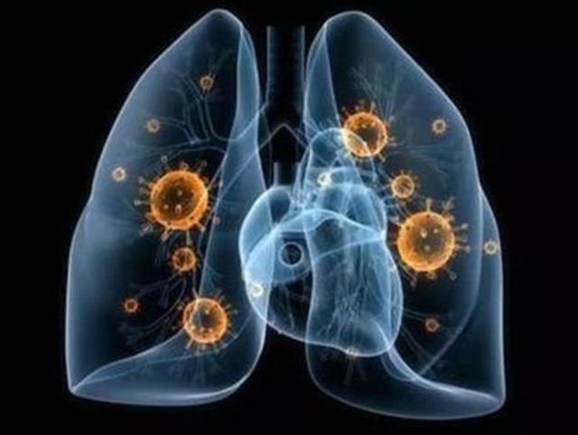 全美已报告新冠肺炎确诊病例19027例，死亡233例